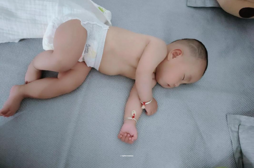 鄢陵宝宝头上长痱子